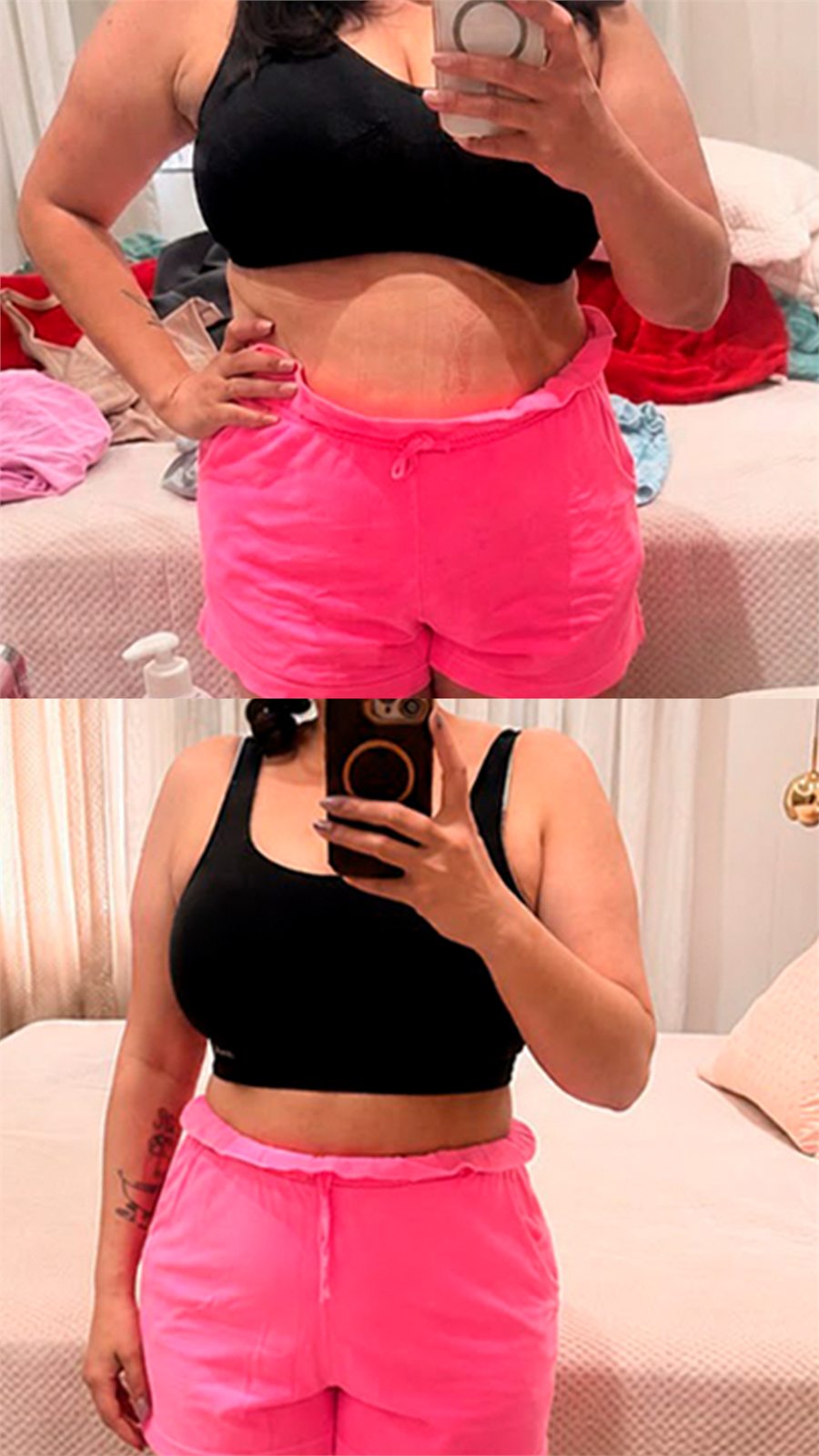 Antes e depois — resultado de cliente Heaven