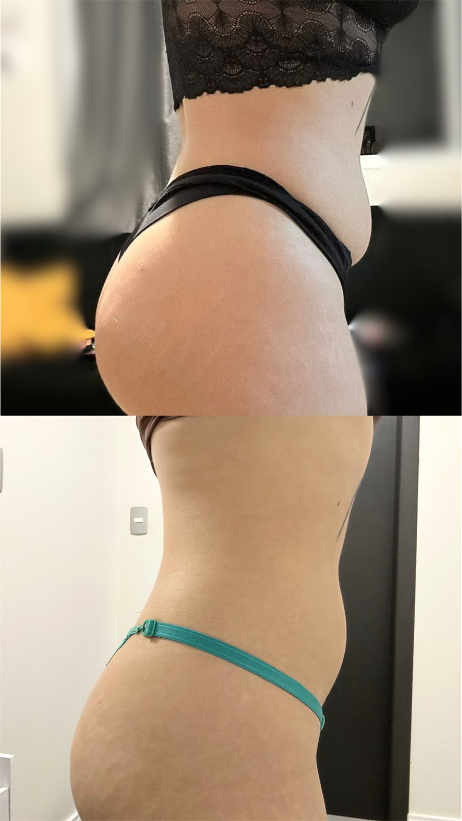 Antes e depois — resultado de cliente Heaven