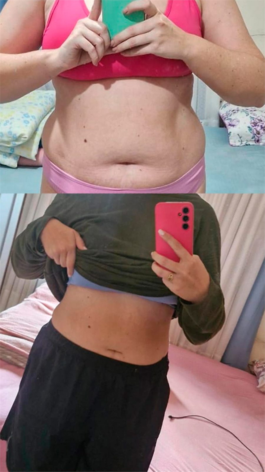 Antes e depois — resultado de cliente Heaven