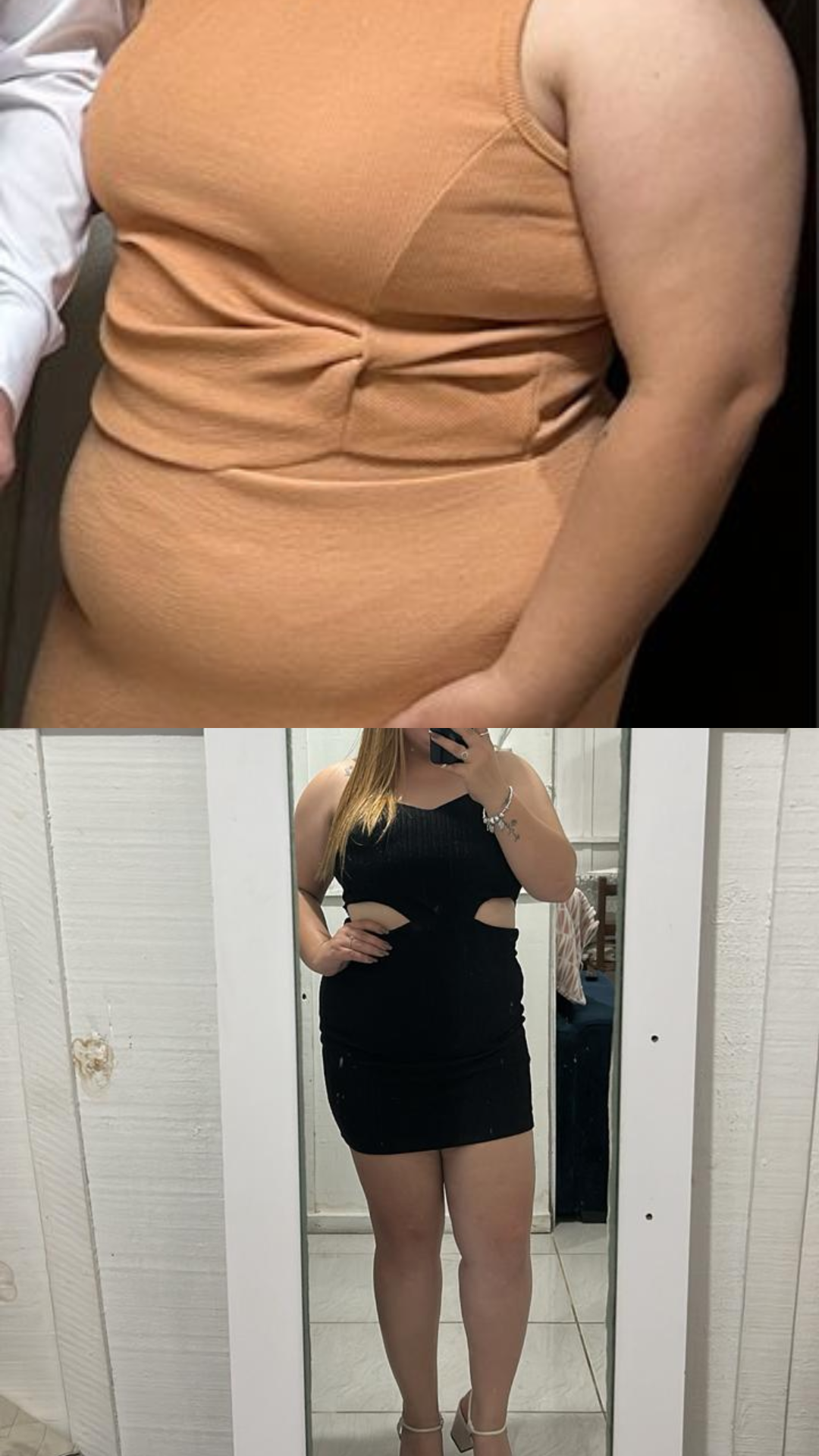 Antes e depois — resultado de cliente Heaven
